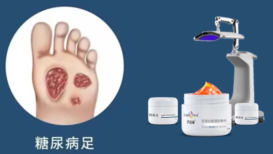 新品芦玫赫：引领糖尿病足治疗进入再生光技术新时代